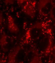 883281201_nqQTLrRD_Lipid_droplet_staining.png